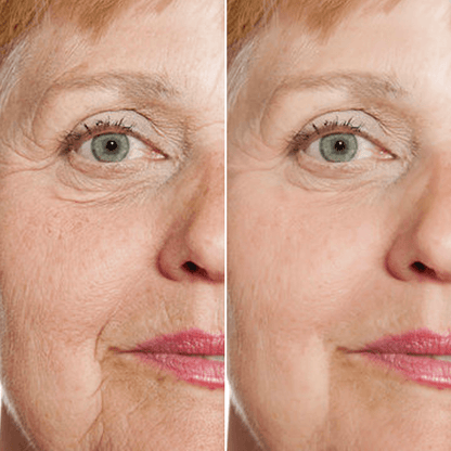 YouthWave™ Rejuvenate Resurfacing Face Serum