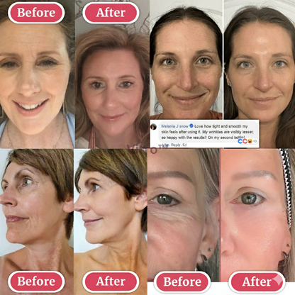 VerraWave™ Calcium Multi Balm